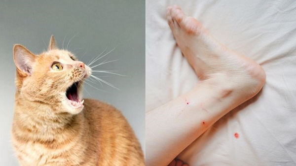 Triệu chứng khi bị mèo dại cắn ở người